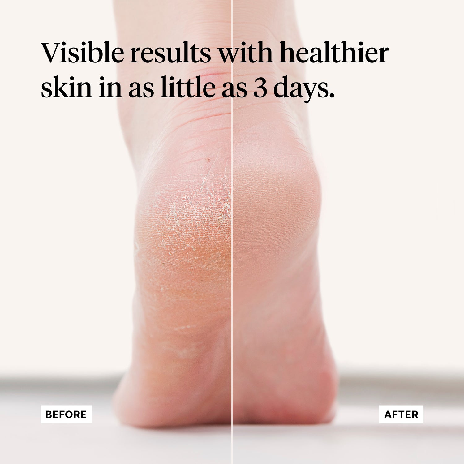 First Honey® Foot Rescue Cream