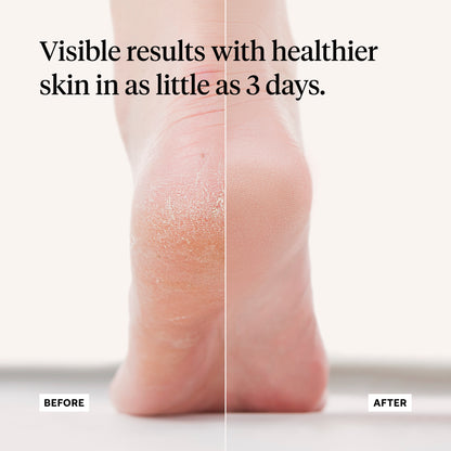 First Honey® Foot Rescue Cream